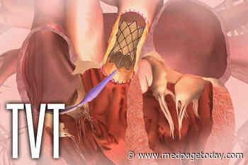 Sapien 3 TAVR On Par with Surgery at 5 Years