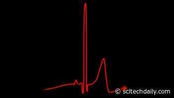 Critically Ill COVID-19 Patients 10x More Likely to Develop Cardiac Arrhythmias