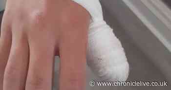 Sunderland teen slices hand on rubbish dumped on rugby pitch