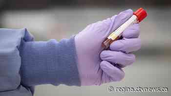 Sask. confirms 5 new COVID-19 cases, no new recoveries