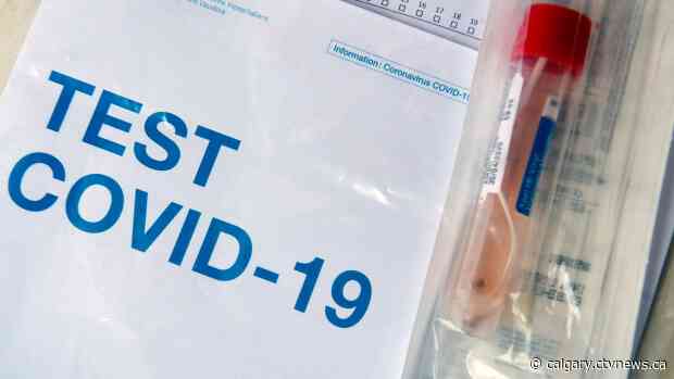Alberta investing $10M in serology testing to help track spread of COVID-19