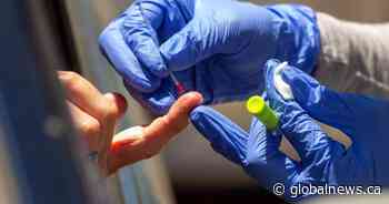 Alberta investing $10M for targeted COVID-19 antibody testing