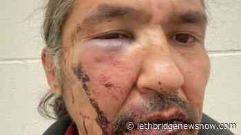 Charges dropped against Alberta First Nations chief in violent arrest - Lethbridge News Now