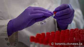 Ontario records fewer than 200 new cases of COVID-19 for second straight day