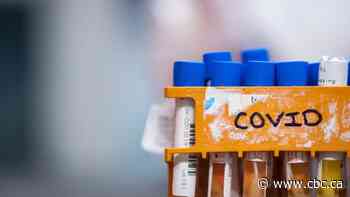 Most recent Sask. data shows 22 per cent of diagnosed COVID-19 cases asymptomatic