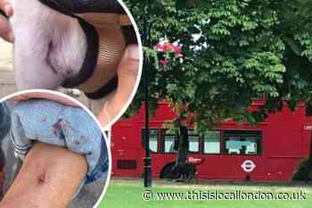 Mother and daughter 'traumatised' after 'vicious' dog attack in Wallington
