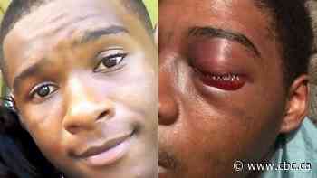 Toronto cop found guilty of assault, brother not guilty, in beating of 19-year-old Black man