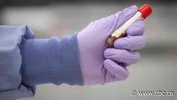 13 new cases of COVID-19 recorded, 10 connected with Maple Creek outbreak