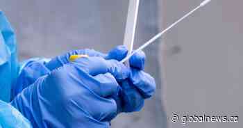 Coronavirus: Alberta returns to ‘gold standard’ nasal pharyngeal swabs as global supply rebounds