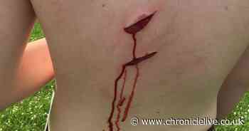 Sunderland boy needed 15 stitches after falling onto broken glass left by louts