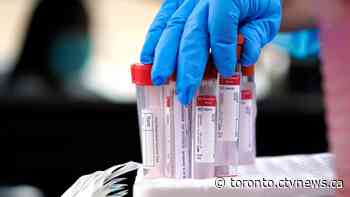 Ontario records slight uptick in COVID-19 cases with 160 new infections