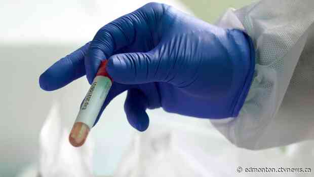 Alberta records biggest jump in COVID-19 cases since May 16