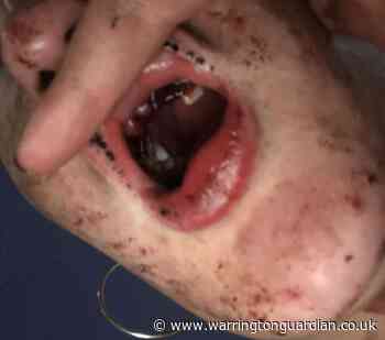 Girl, 17, charged after serious assault on Bennetts Rec