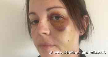 Police officer punched in face during vicious lockdown attack