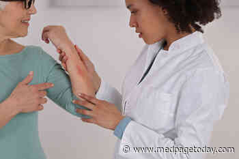 Minimal Link Between Eczema and Most Cancers