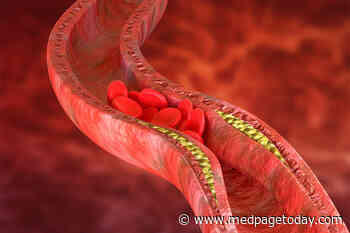 Cardiovascular Risks Persist in Lupus