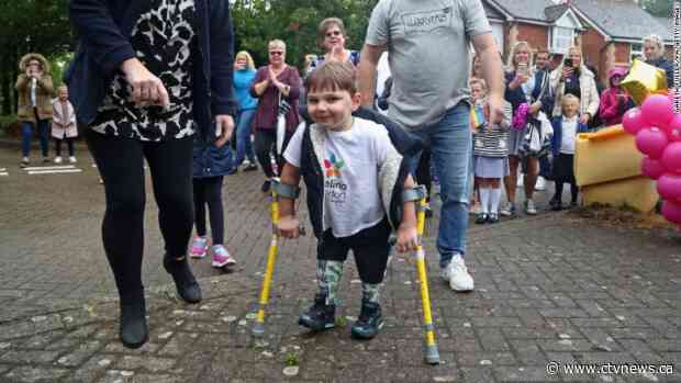 A 5-year-old boy with prosthetic legs raises $1.7 million by walking 9.6 kilometres