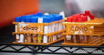 Alberta confirms 57 new cases of COVID-19 on Friday