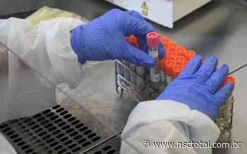 Covid-19: Blumenau encaminha compra de 10 mil testes do tipo RT-PCR - NSC Total