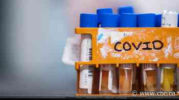 1st glimpse of Canada's true COVID-19 infection rate expected mid-July from immunity testing