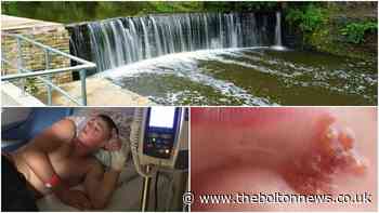 Mill water warning as teens fall ill after swim