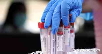 Coronavirus: No new cases for Kawartha Lakes, Northumberland, Haliburton counties - Globalnews.ca