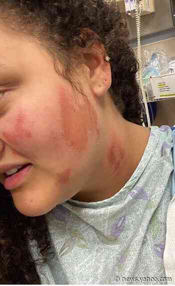 Black Americans report hate crimes, violence in wake of George Floyd protests and Black Lives Matter gains