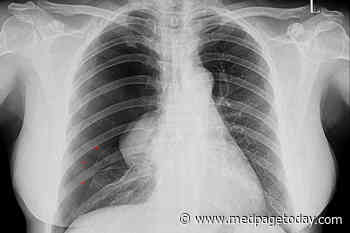 COVID-19 Lungs May Be More Likely to Leak
