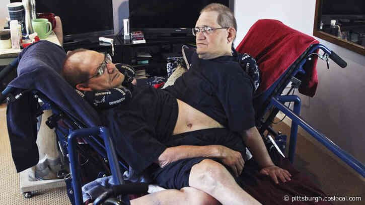 World’s Longest-Surviving Conjoined Twins Die At 68