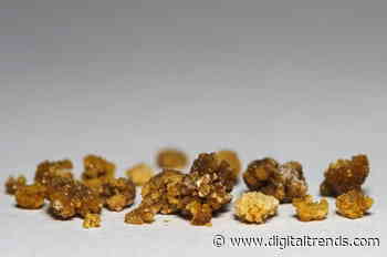 Ultrasonic ‘tweezers’ can remove huge kidney stones without invasive surgery