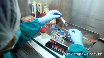 Pelotas registra o sexto óbito e total de 347 casos de coronavírus - Revista News