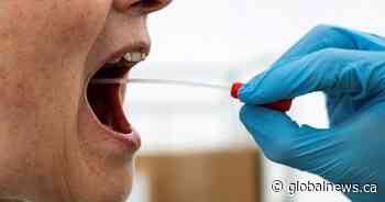 Mobile coronavirus testing clinic planned for Ottawa East on Saturday - Globalnews.ca