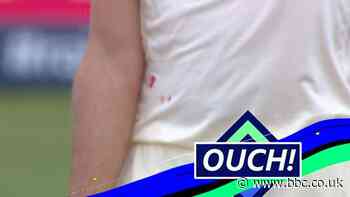 England v West Indies: Holder draws blood with bouncer that hits Sibley on elbow