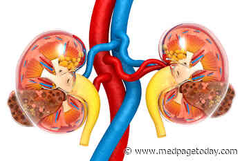 Alternative CKD Screening Methods Cheap, Clinically Useful
