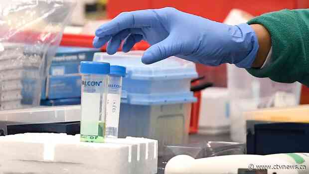 Potential COVID-19 vaccine approved for human trial in Canada is stuck in China