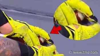 WWE's Rey Mysterio 'Loses Eyeball' In Live Match, Seth Rollins Pukes!