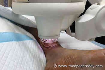 Cold Plasma Speeds Diabetic Ulcer Healing
