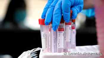 Ontario records highest number of new COVID-19 cases since June