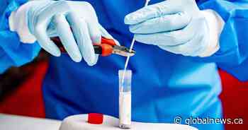 Eight new coronavirus cases, 11 more recoveries reported in Saskatchewan