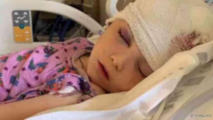 7-year-old boy hospitalized after horrific attack in California