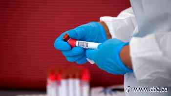 COVID-19 in Sask.: 27 more cases announced Friday, including 24 in southern region