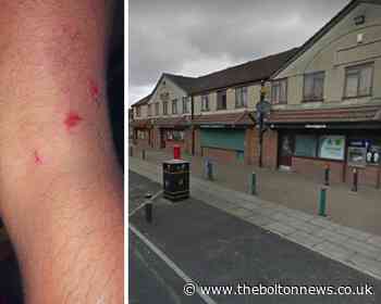 Brave pals fight off huge dog after attack on teen in Bolton - The Bolton News