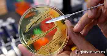 U.S.-linked salmonella outbreak leads to 59 cases across 5 provinces