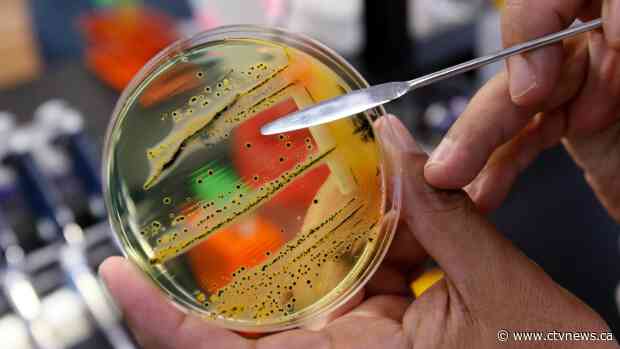 Salmonella outbreak linked to U.S. hits five provinces, but source still unknown