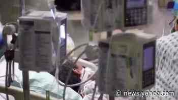 COVID-19 puts critical medical transplants on hold - Yahoo News