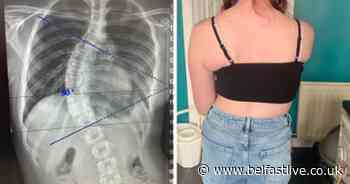 Carrickfergus child's bid for surgery for 50 degree curve on spine - Belfast Live