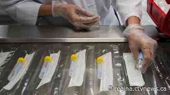 Sask. reports 31 new COVID-19 cases, 14 in hospital