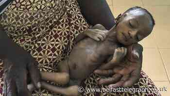 Coronavirus-linked hunger tied to 10,000 child deaths each month