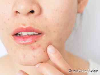 How to prevent acne from face masks     - CNET