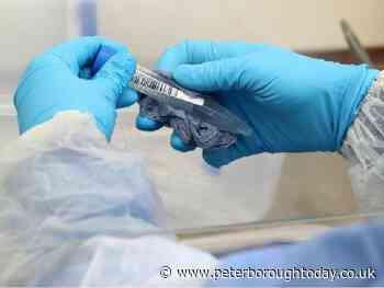 Coronavirus: Slight rise in Peterborough’s rate of new cases - Peterborough Telegraph